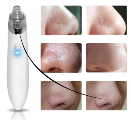 DeluxeSkin™ 4-in-1 Multifunctional Beauty Pore Vacuum